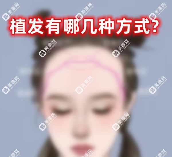 植发有哪几种方式?6种植发技术区别(含微针/fue/宝石刀/fut)