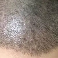 为了不秃头大家都拼了！究竟有多少种方法可以让头发看起来很茂密？
