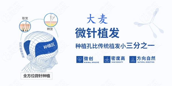 <!--<i data=20240703-sp></i>-->微针植发