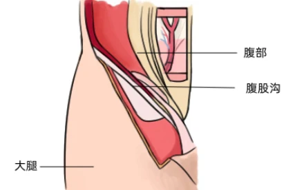 大腿内侧腹股沟图
