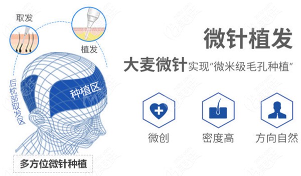 大麦专属的微针植发技术
