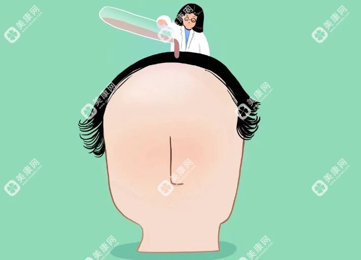 一万块钱可以植发1000-1400个毛囊左右,相当于16-40个平方厘米