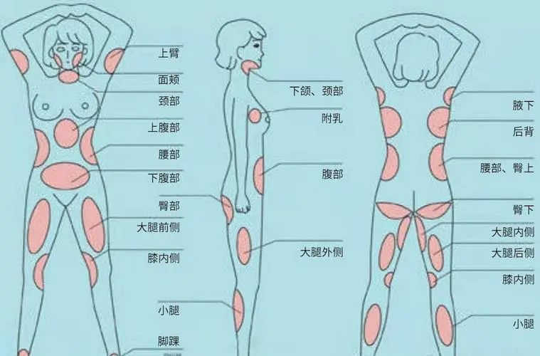 人体腿部位名称大全图解 腿部各个部位名称图