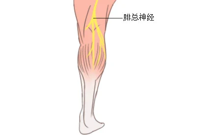 腓总神经位置图