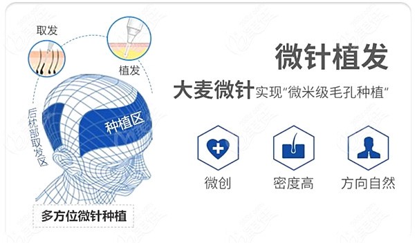 扬州大麦微针植发价格表在这