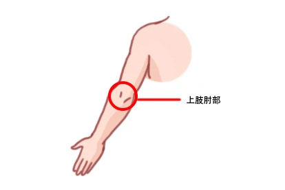 上肢肘部图片