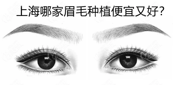 <!--<i data=20240703-sp></i>-->哪家眉毛种植便宜又好？