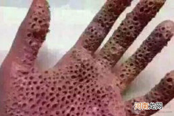芝麻女孩和玉米男孩,有人身上真的发生过类似的恐怖情况,这么人还能活吗?