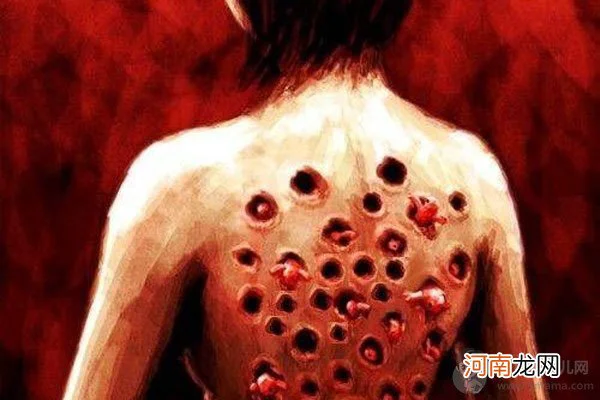 芝麻女孩和玉米男孩,有人身上真的发生过类似的恐怖情况,这么人还能活吗?